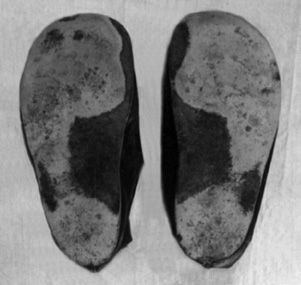 Wear on Shoe Soles